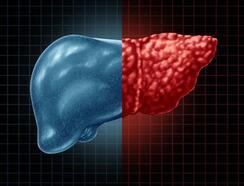 Karaciğer yağlanmasını tetikleyen 8 risk faktörü