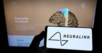 Musk'ın beyin implantı girişimi Neuralink, insanlı deney için onay aldı!