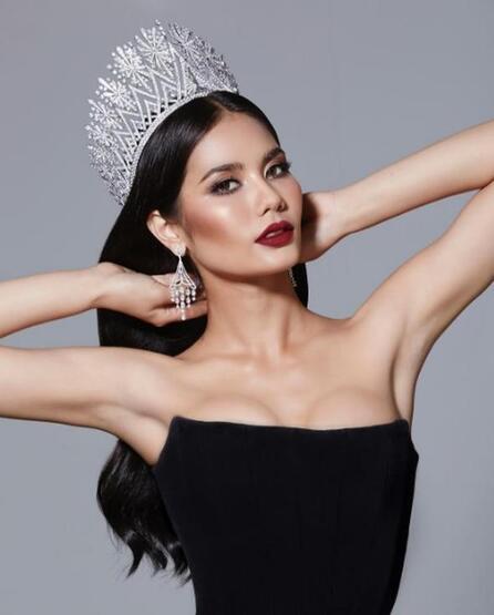Miss Universe güzelinin 6 ay önceki hali şoke etti!