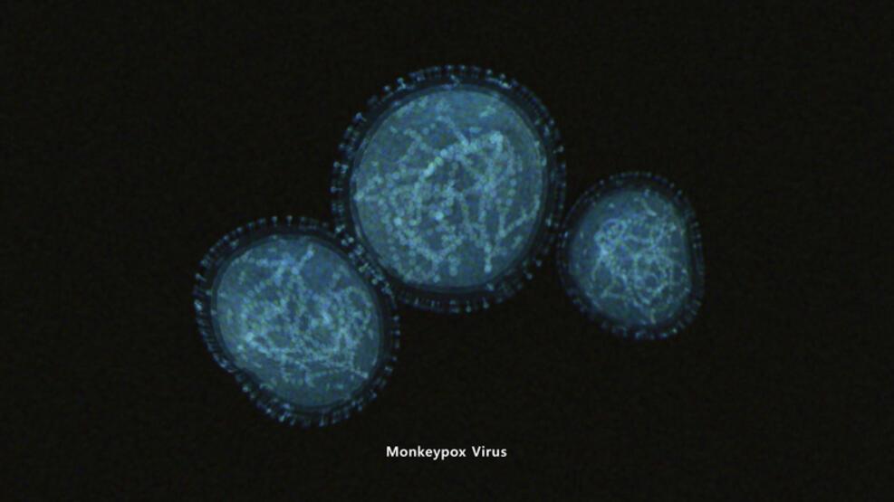 Koronavirüsün yerini mi alacak? DSÖ'den dikkat çeken Maymun Çiçeği açıklaması