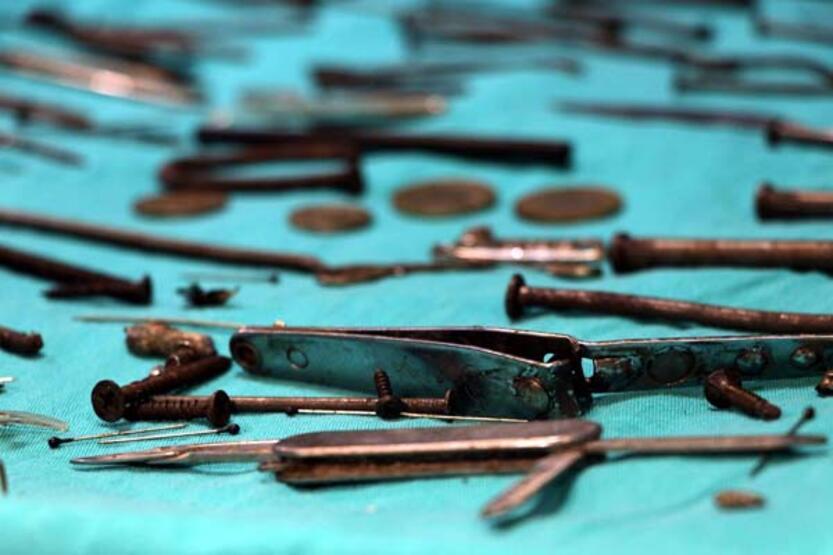 Midesinden çivi, bıçak, tırnak makası gibi 158 parça metal çıkarıldı