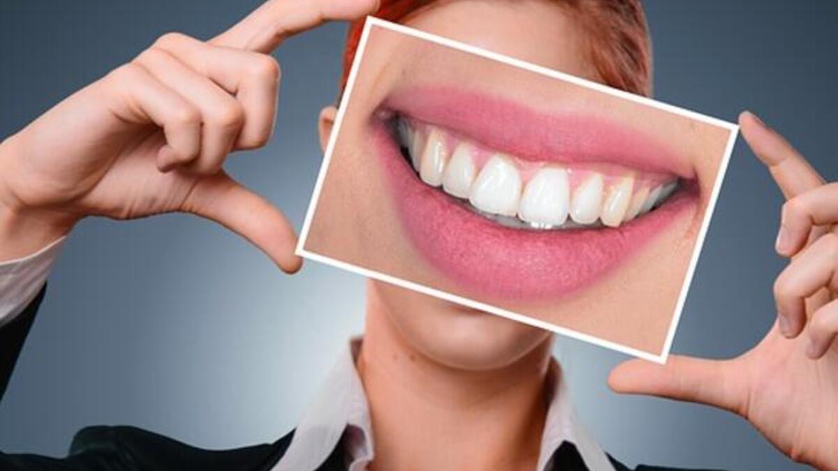 Düzenli diş temizliğinin genel sağlık üzerindeki muhteşem etkisi - Sağlık Haberleri