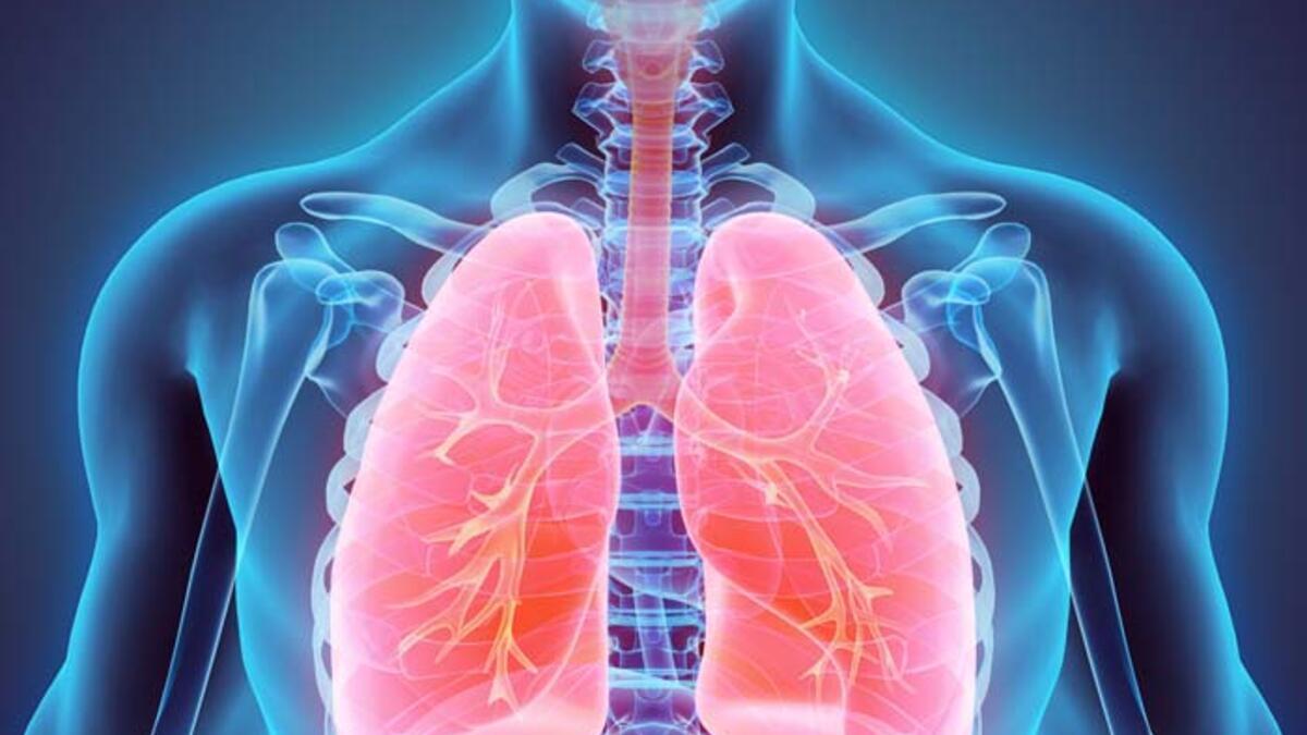 Ciğerlerin Su Toplaması (Akciğerde Su Toplaması)Belirtileri Nedenleri Tedavisi