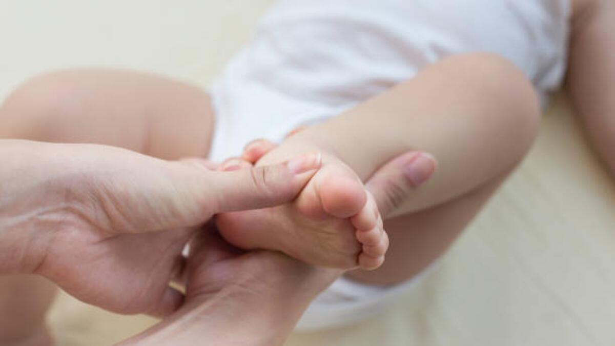Doğuştan çarpık ayak sorunu ameliyatsız tedavi edilebiliyor