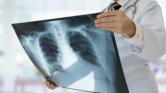 What is a lung infection, does it cause?  How is a lung infection treated?
