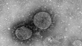 Bilim Kurulu Üyesi Özlü: Koronavirüs akciğerlerde kalıcı hasara yol açtı