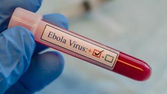 Uganda’daki Ebola salgınında can kaybı 29’a yükseldi