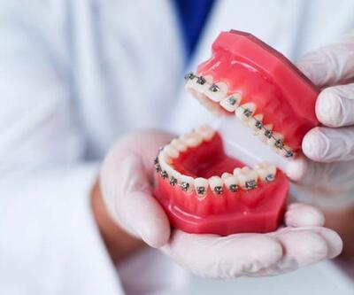 Dijital lingual ortodonti nedir