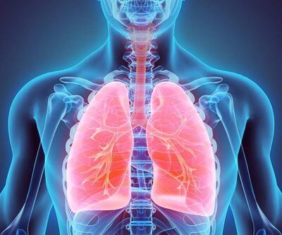 Adenokarsinom Nedir Adenokarsinom Metastazı Ne Demek Akciğer Kanserinin Yaşama Süresi