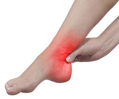 En sık görülen ayak sorunu topuk ağrısı