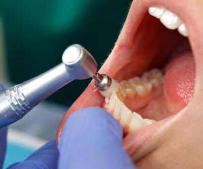 Yirmilik Diş Ağrısı Nasıl Geçer 20lik Diş Ağrısına Ne İyi Gelir