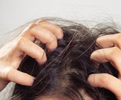 Saç Derisi Kaşıntısı Neden Olur, Neyin Belirtisidir Saç Kaşıntısı Nasıl Geçer