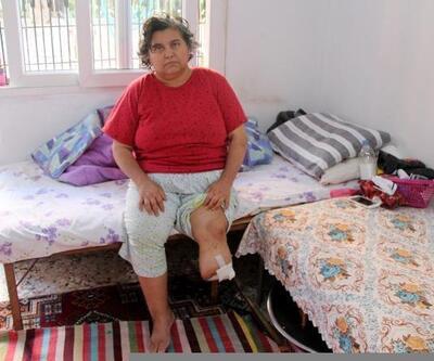 Ayağı kesilen diyabet hastası, protez bacak için yardım bekliyor