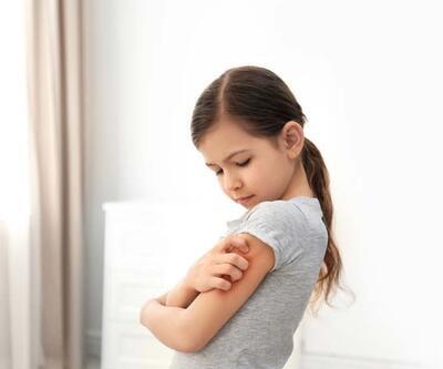 Alerjik çocuklar için 14 altın tavsiye