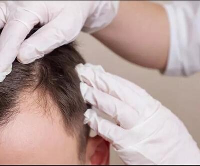 Keratin takviyeleri saç derisi sağlığını olumlu yönde etkiler mi