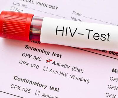 HIV-AIDS’te erken teşhis ve düzenli takip ölümleri azaltıyor