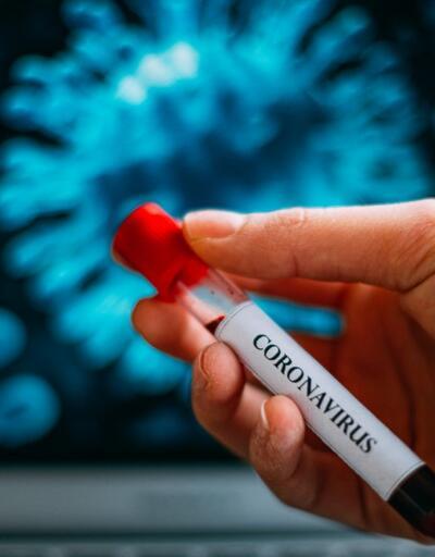 Covid-19 Corona virüsü son dakika haberleri: Ölü ve vaka sayısı arttı