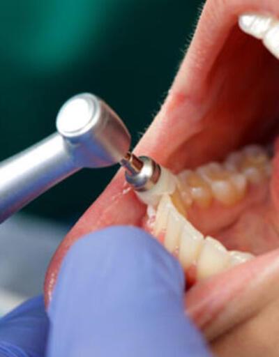 Yirmilik Diş Ağrısı Nasıl Geçer 20lik Diş Ağrısına Ne İyi Gelir