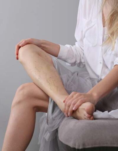 Kadınlar erkeklerden 9 kat fazla ayak ağrısı çekiyor