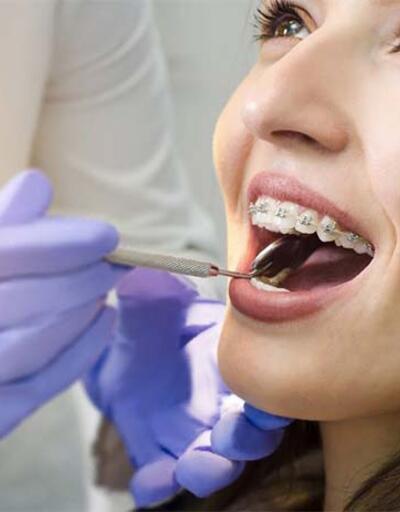 Diş boşlukları ortodontik tedavi ile kapatılabilir