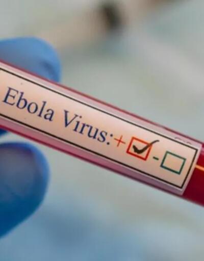Uganda’daki Ebola salgınında can kaybı 29’a yükseldi