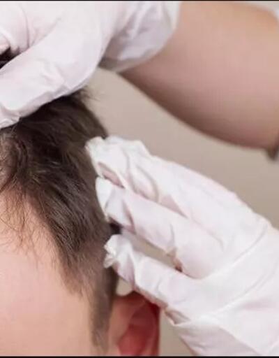Keratin takviyeleri saç derisi sağlığını olumlu yönde etkiler mi
