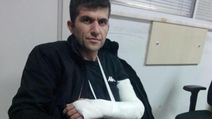 Grup Yorum üyesi Ali Aracı'nın gözaltında kolunu kırdılar