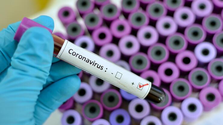 Corona virüsünde son durum ne? Koronavirüste ölü sayısı artıyor!