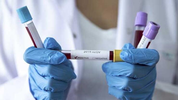 İngiltere'de Kovid-19 antikor testleri yakında satışa sunulacak