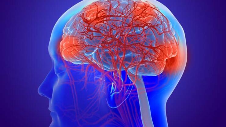 Beyin pili ameliyatında hastalar neden uyanık kalıyor?
