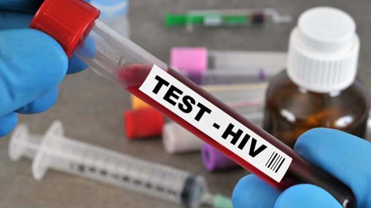 Aids Testi Nedir? Nasıl Ve Nerede Yapılır? Aids Testi Ne Zaman Yapılmalı?