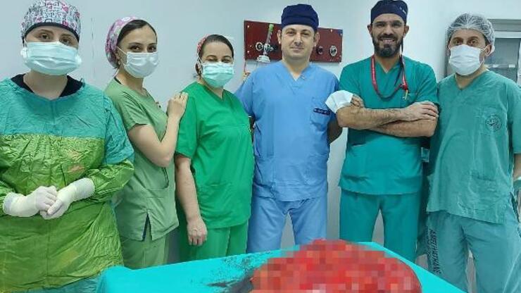 'Gaz' şikayetiyle gittiği hastanede karnından 21 kilo tümör çıkarıldı