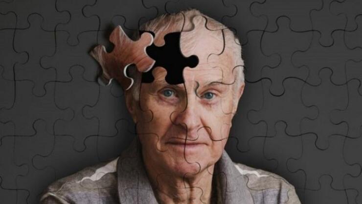 Alzheimer Nedir, Neden Olur? Alzheimer Belirtileri Nelerdir, Tedavisi Nasıl Yapılır?