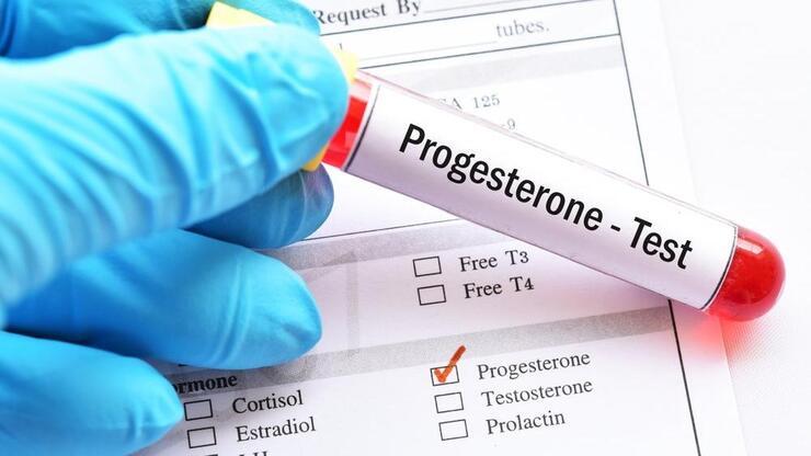 Progesteron Hormonu Nedir, Ne İşe Yarar? Progesteron Hormonu Değeri Kaç Olmalıdır?