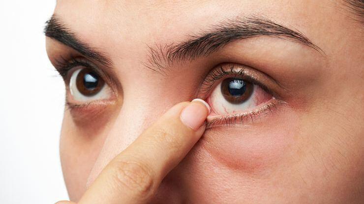 Yaz aylarında en sık görülen göz hastalıkları
