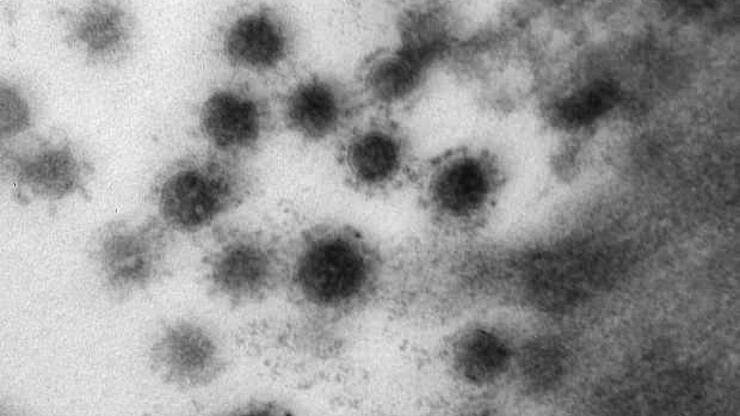 Koronavirüsün delta varyantı Rusya'da görüntülendi