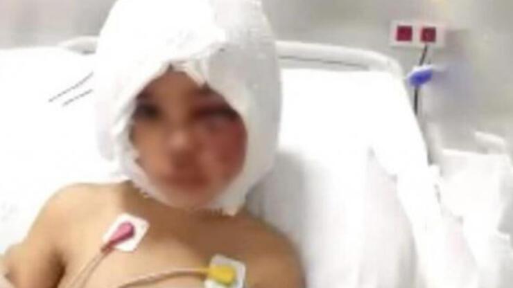 Pitbull saldırısına uğrayan çocuğun doktoru: Böylesini meslek hayatımda  görmedim - Son Dakika Flaş Haberler