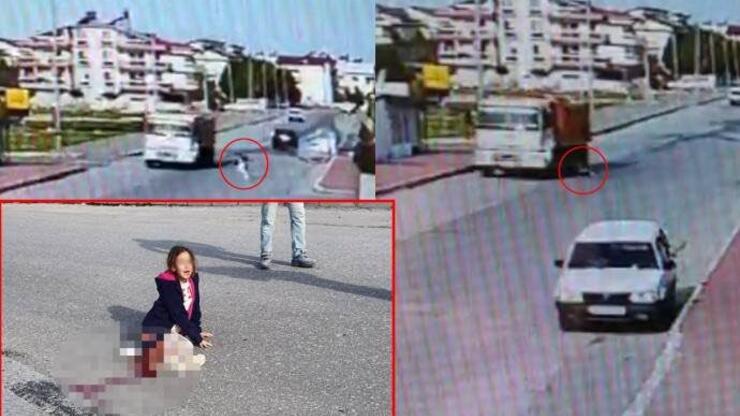 Mahra Melin Pınar olayı nedir, ne oldu? Sağ bacağı kesildi!