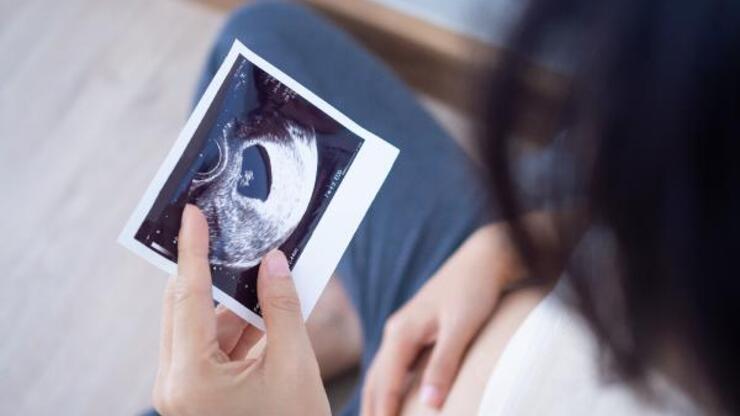 “Akraba evliliklerinde fetal anomalilerin anne karnında tanısı mümkün olabiliyor”
