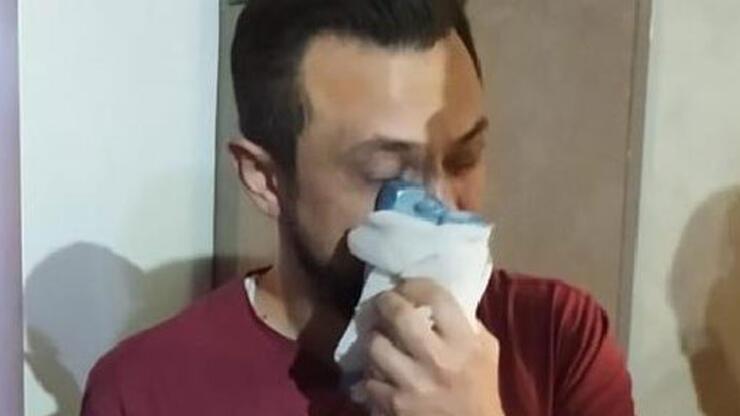Şanlıurfa’da saldırıya uğrayan doktorun burnu kırıldı