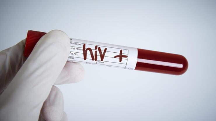 1 Aralık dünya ne günü? Dünya AIDS ile Mücadele Günü nedir? HIV ve AIDS nasıl bulaşır?