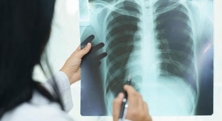 Akciğer Enfeksiyonu Nedir, Neden Olur Akciğer Enfeksiyonu Tedavisi Nasıl Yapılır