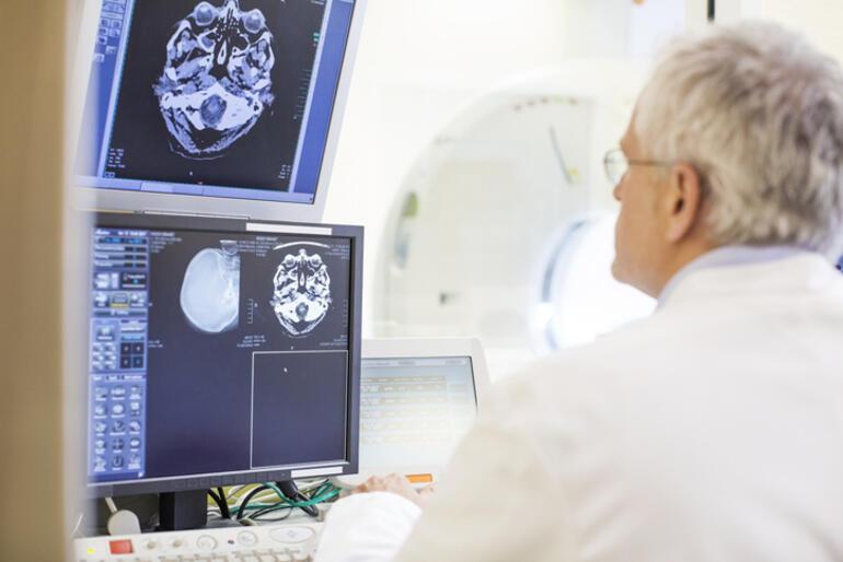 What diseases can be diagnosed with brain MRI What diseases are diagnosed with brain MRI